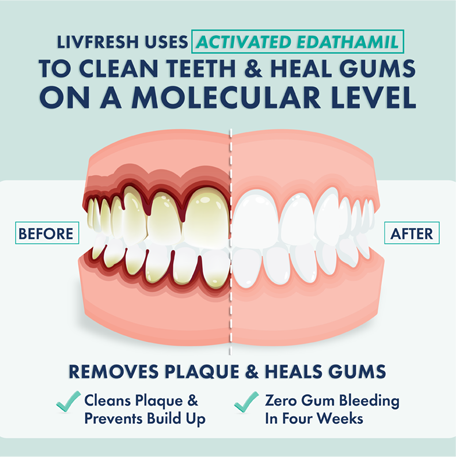 🔥Final 3 Hours:70%ОFF🔥Ultra Foaming Wintergreen Toothpaste - 250% Plaque Removal, Whitening & Fresh BreathToothpaste