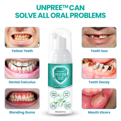 💥Last Day 70% OFF💥™ TEETH Herbal Kolirin Mouthwash - Solve all Oral Problems